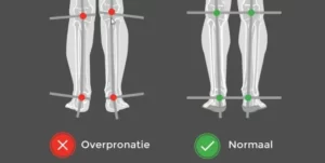 Hardloopschoenen zelf aanmeten pronatie 2