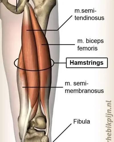 hamstringblessure