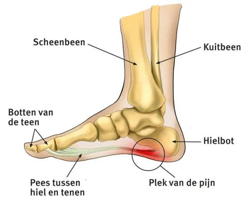 hielspoor